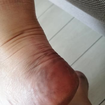 Hotiç Botların Kalitesizliği Ve Müşteri Güvenine Saygısızlık