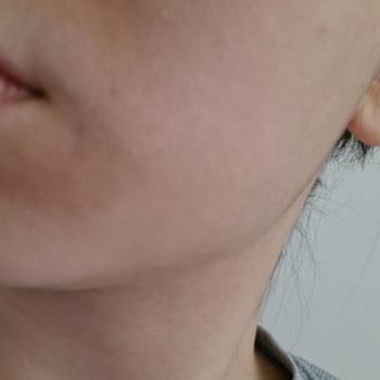 Cream Co. Cilt Sorunlarına Neden Olan Güneş Kremi Deneyimi