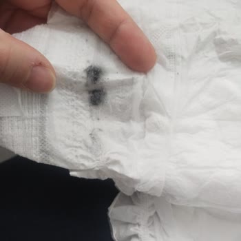 Bebek Bezinde Şaşırtıcı Siyah Madde