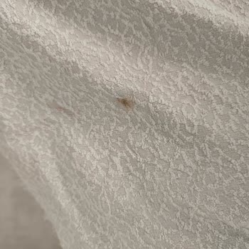 Beko Çamaşır Makinesi Lekeleri Çıkarmıyor Ve Servis Sorunları