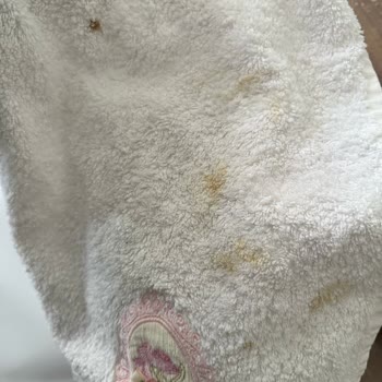 Beko Çamaşır Makinesi Lekeleri Çıkarmıyor Ve Servis Sorunları