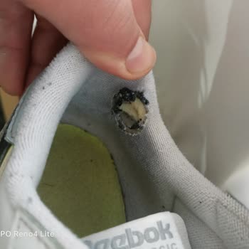 Ayakkabı Topuğundaki Sorun Çözülmedi!