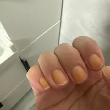 Flormar Oje Kalıcı Lekeler Bırakıyor