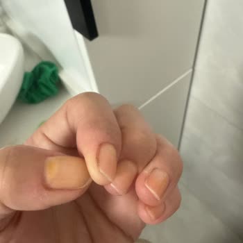 Flormar Oje Kalıcı Lekeler Bırakıyor