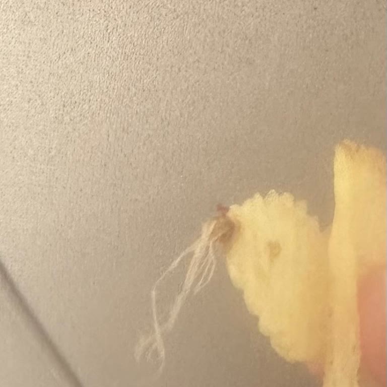 Cipsten Çıkan Yabancı Madde Şoku