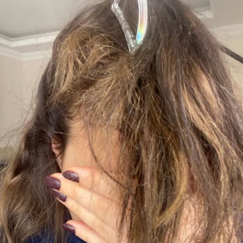 Hair Light | Maltepe Kuaförde Hayal Kırıklığı: Yanmış Saçlar