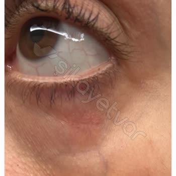 Problemas de piel con productos Estee Lauder