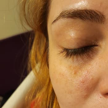 Reacción inesperada con crema de ojos Estee Lauder