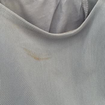 Zara'dan Lekeli Ürün Şoku: Çözüm Bekliyorum!
