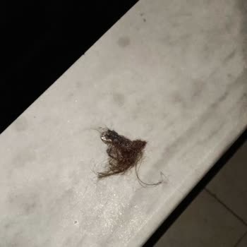 Çevre Ve Şehircilik Bakanlığı Balkonuma Atılan Çöpler Ve İzmaritler: Acil Müdahale Bekliyorum!