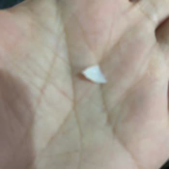 Tavuk Burgerde Tehlikeli Plastik Parça