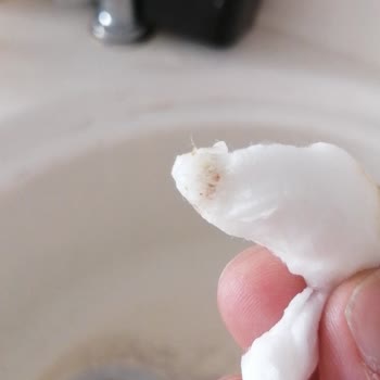 Su Arıtma Cihazı Servis Sorunu Ve Çeşme Değişim Beklentisi