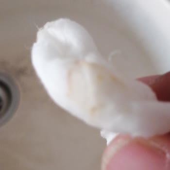 Su Arıtma Cihazı Servis Sorunu Ve Çeşme Değişim Beklentisi