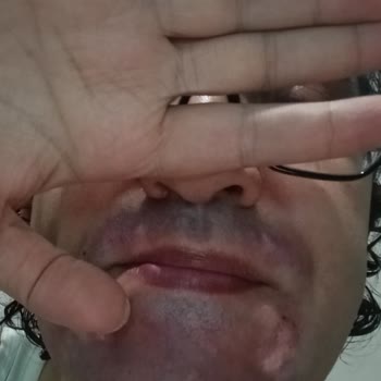 Kepeğe Karşı Etkili Şampuan Saçlarımı Mahvetti