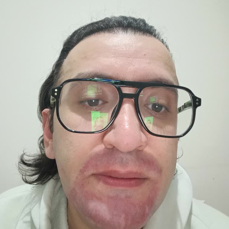 Kepeğe Karşı Etkili Şampuan Saçlarımı Mahvetti