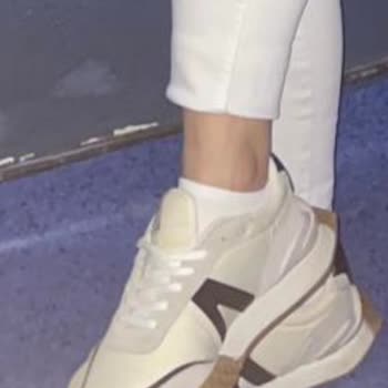 Ayakkabı Renk Sorunu Ve Kalite Şikayeti