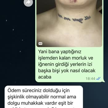 Estetikte Hayal Kırıklığı Ve Hijyen Sorunu