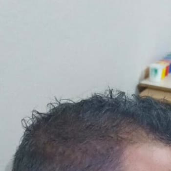 Yanlış Renk Çıkan Saç Boyası Mağduriyeti