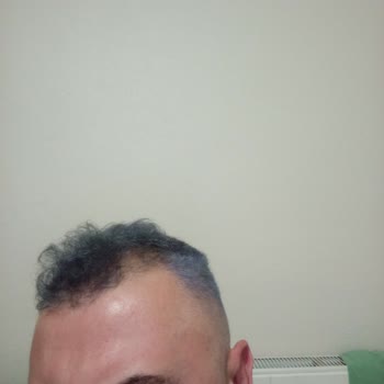 Yanlış Renk Çıkan Saç Boyası Mağduriyeti