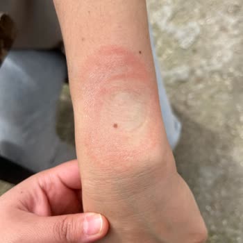 Huawei Saat Egzama Sorunu Ve İade Krizi