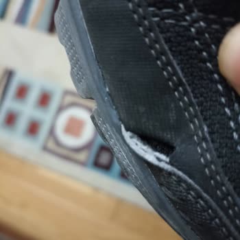 Skechers Ayakkabı Garanti Sorunu Ve Tüketici Hakları Mücadelesi