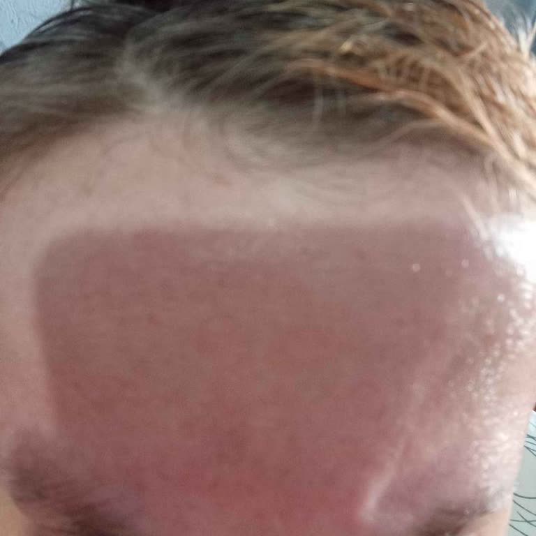 Cilt Sorunları Ve İade Zorlukları: Trendyol Ve Jeuvenile Hayal Kırıklığı