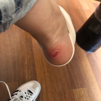 Yanlış Numara Ve Kusurlu Ürün Nedeniyle Mağduriyet Yaşadım