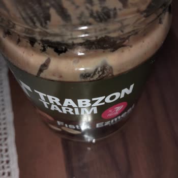 Fıstık Ezmesi Yüzünden Dişim Kırıldı Ve Büyük Risk Taşıyor