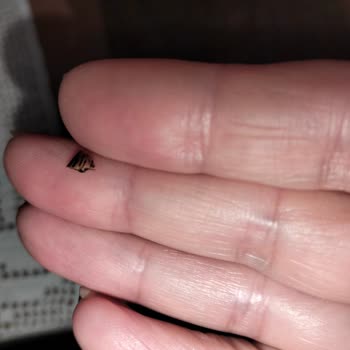 Fıstık Ezmesi Yüzünden Dişim Kırıldı Ve Büyük Risk Taşıyor