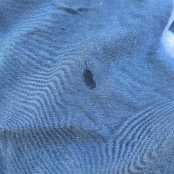 Miele Çamaşır Makinesi Lekeli Yıkama Sorunu!