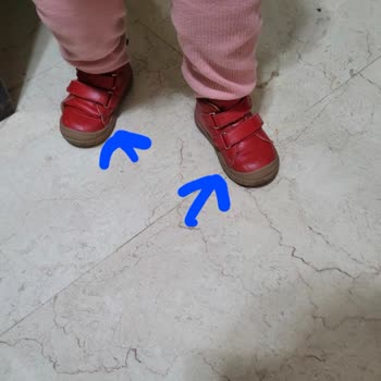 Kifidis Çocuk Ayakkabısındaki Dikiş Sorunu Ve Tamir Talebi