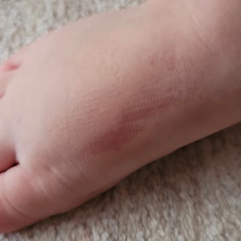 Kifidis Çocuk Ayakkabısındaki Dikiş Sorunu Ve Tamir Talebi