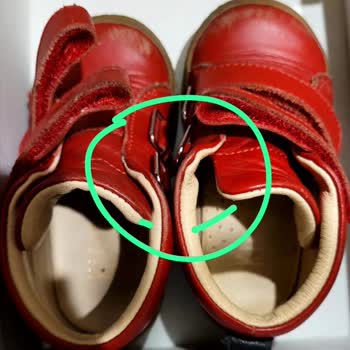 Kifidis Çocuk Ayakkabısındaki Dikiş Sorunu Ve Tamir Talebi