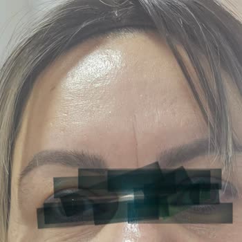 Fiber Perukta Hayal Kırıklığı Ve Mağduriyet