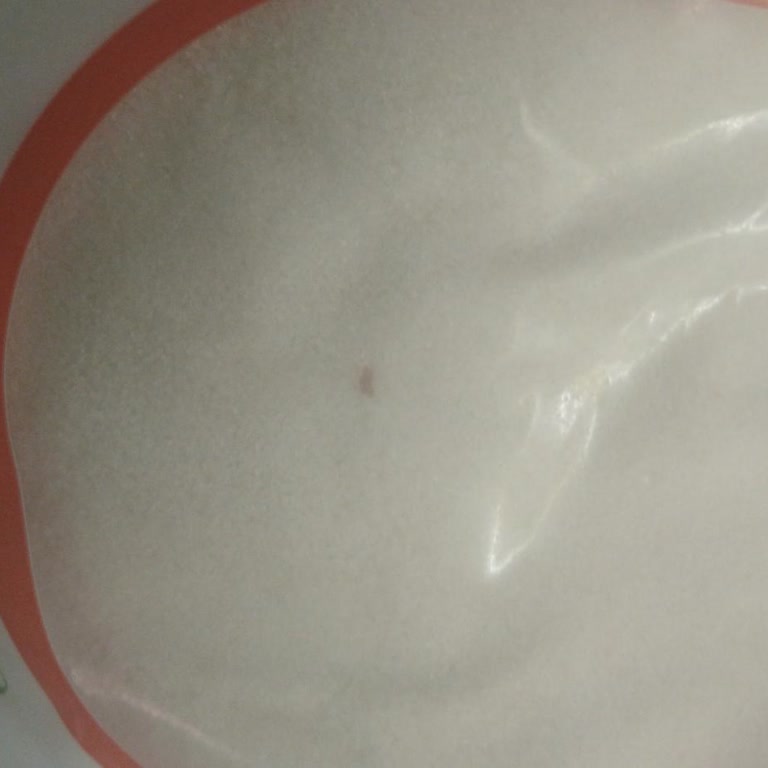 Migros'tan Aldığım Şekerin İçinden Çıkan Siyah Noktalar