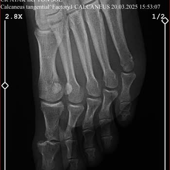 Yanlış Tedavi Yüzünden Hayatım Kısıtlandı