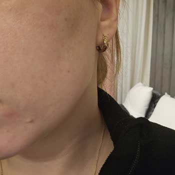 La Roche - Posay Krem Alerji Yaptı, Para İadesi Yapılmıyor