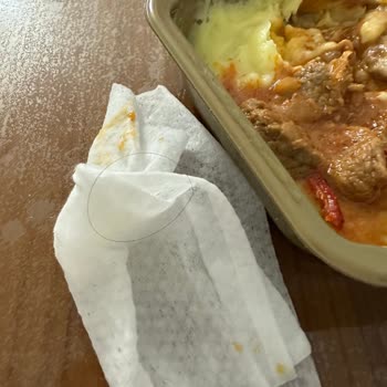 Hijyen Skandalı: Yemekten Saç Çıktı!