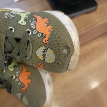 Vicco Ayakkabı: 3 Günlük Kullanımda Zedelenme Ve İade Talebi