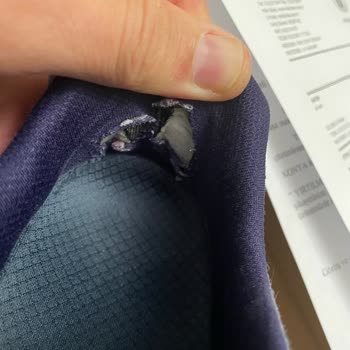 Skechers Ayakkabının Hızla Deformasyonu Ve Olumsuz İnceleme Sonucu