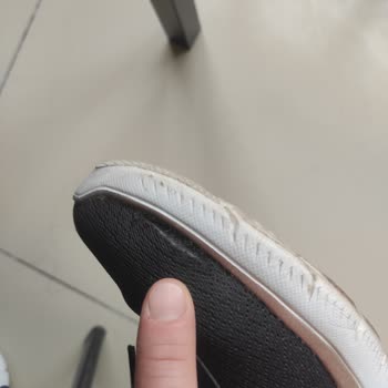 Skechers Ayakkabıda Açılma Ve Yetersiz Müşteri Hizmeti