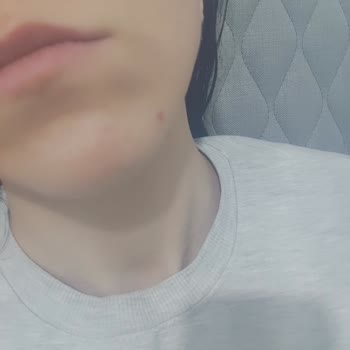 Ciltte Sivilce Yapan Pudra Sorunu