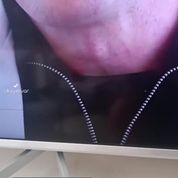 Philips TV Sol Altta Yatay Çizgi Var