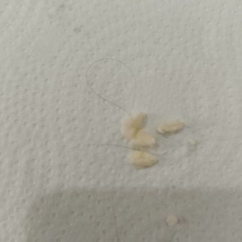 Has Tulum Peynirinden Kıl Çıktı!