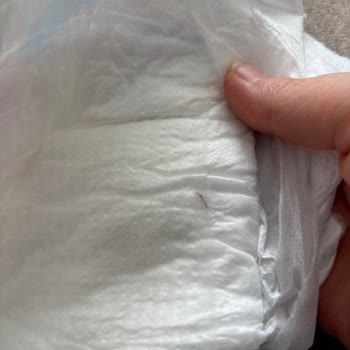 Bebek Bezinde Tehlikeli Cisim Şoku