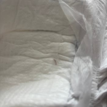 Bebek Bezinde Tehlikeli Cisim Şoku