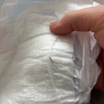 Bebek Bezinde Tehlikeli Cisim Şoku