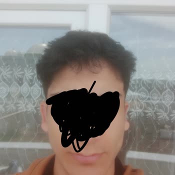 Başarısız Kepçe Kulak Ameliyatı Ve Mağduriyet