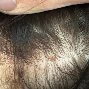 Hair Label Ataköy Kuaförde Fiyat Farkı Ve Sağlık Sorunları