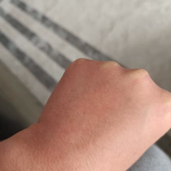 Bulaşık Deterjanı Ellerimi Mahvetti